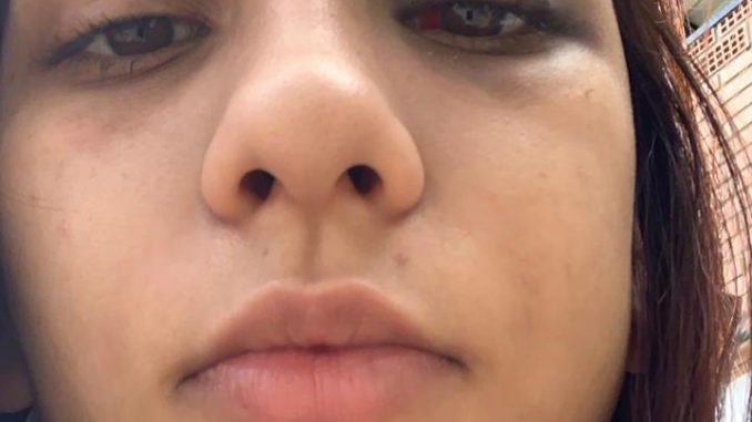 rafaela agressao